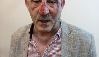 Ağrı’da sağlık çalışanına saldırı