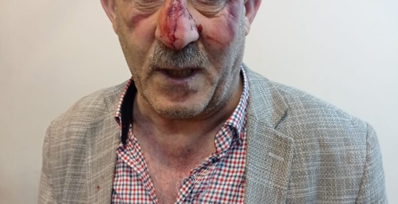 Ağrı’da sağlık çalışanına saldırı