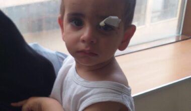 Köpeklerin saldırısına uğrayan minik Asaf hayatını kaybetti